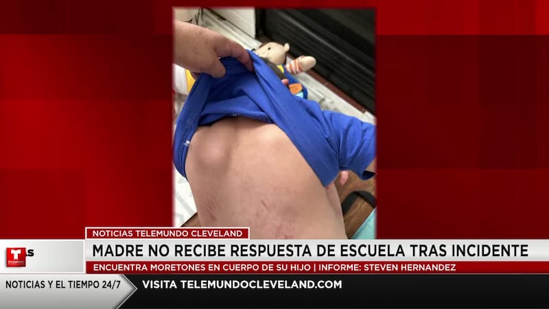 Madre busca respuestas de escuela tras incidente con su hijo